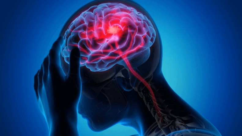 Best Neurology Treatment in New Delhi