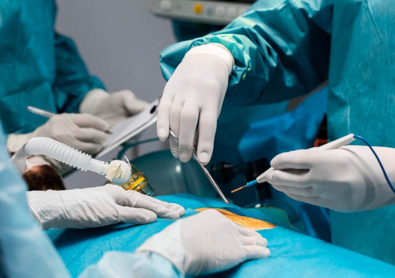 Best General Surgery in Delhi